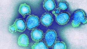 H3N2 Virus: कोरोना के बाद अब H3N2 वायरस का कहर, अब तक 9 लोगों की मौत, यहां 26 मार्च तक सभी स्कूल बंद करने के निर्देश